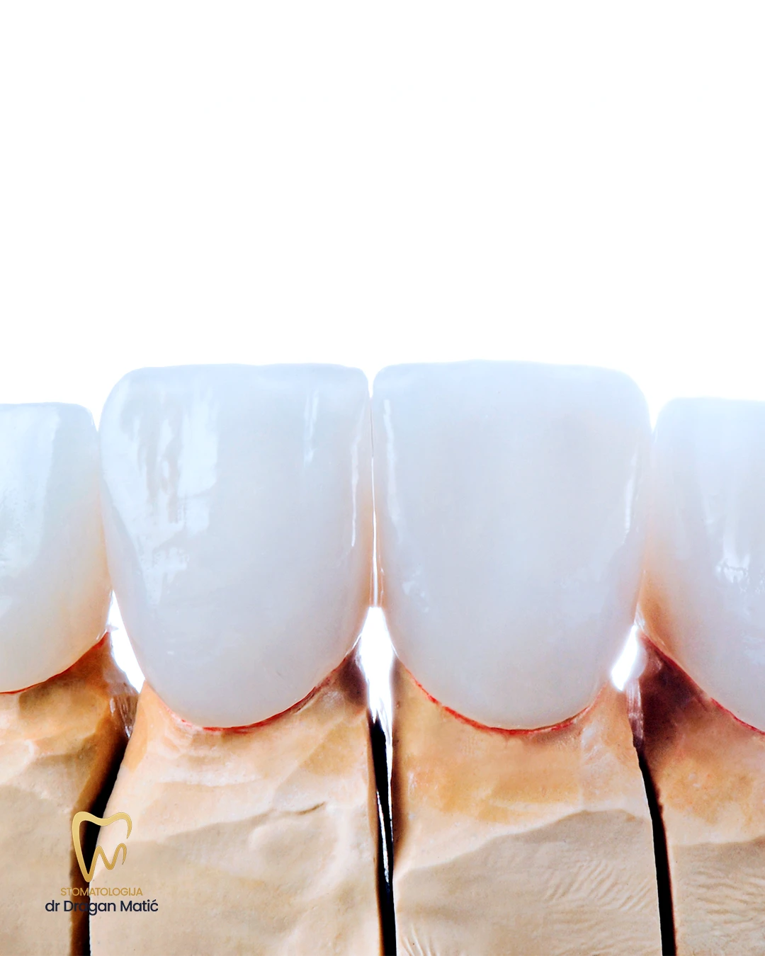 mreze-moodboard-1350x1080-zubi-stomatologijamatic-ba